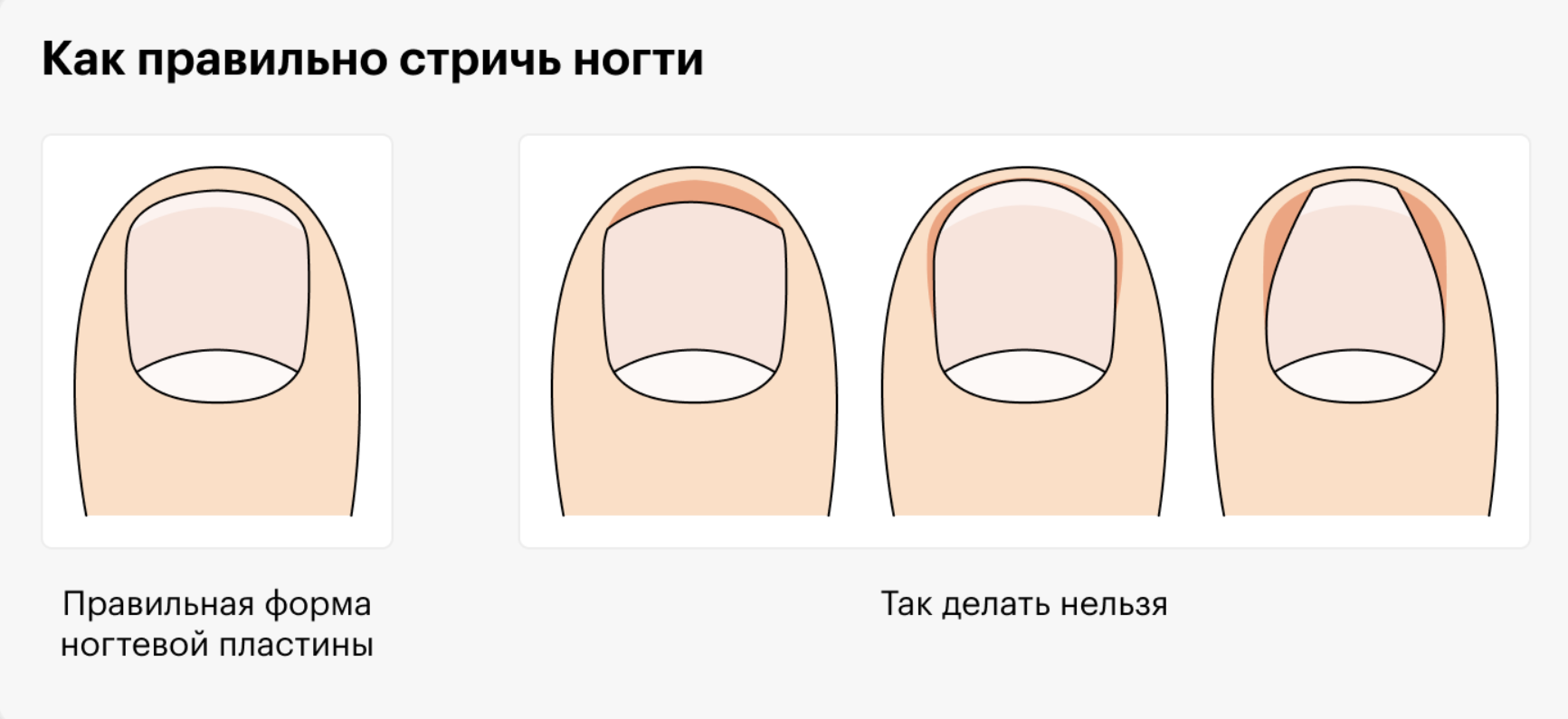 Как подрезать ногти на ногах правильно